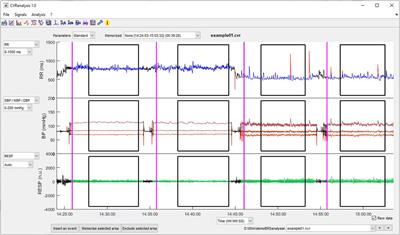 CVRanalysis: a free software for analyzing cardiac, vascular and respiratory interactions